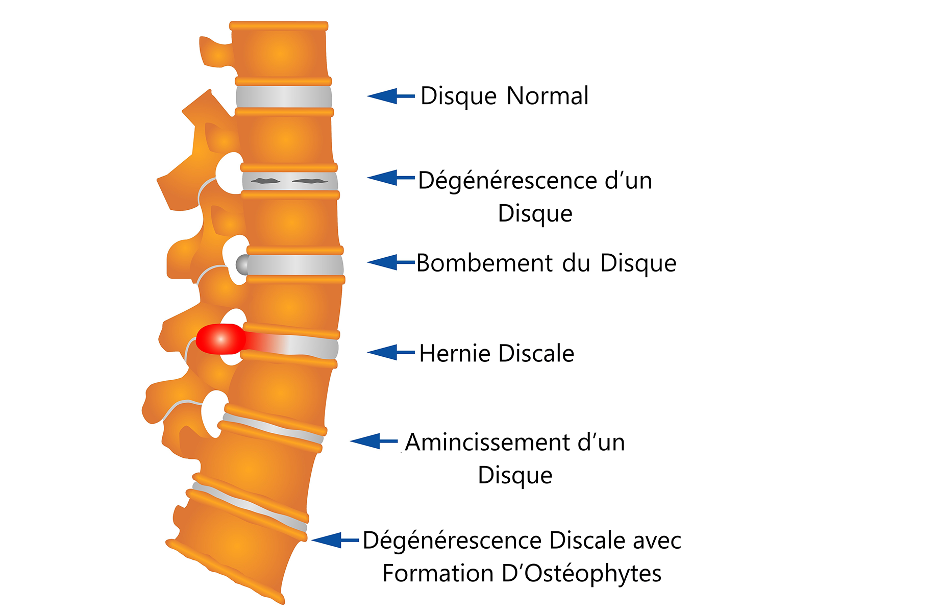 Figure 2 - description détaillée suit immédiatement